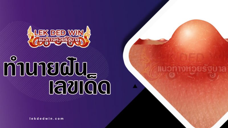 ภาพปกทำนายฝันว่าเป็นฝี