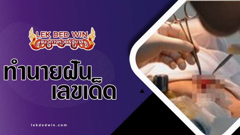 ทำนายฝันว่าโดนตัดอวัยวะขาด-พร้อมเลขเด็ด