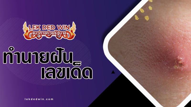 ทำนายฝันว่าฝีแตก-พร้อมเลขเด็ด