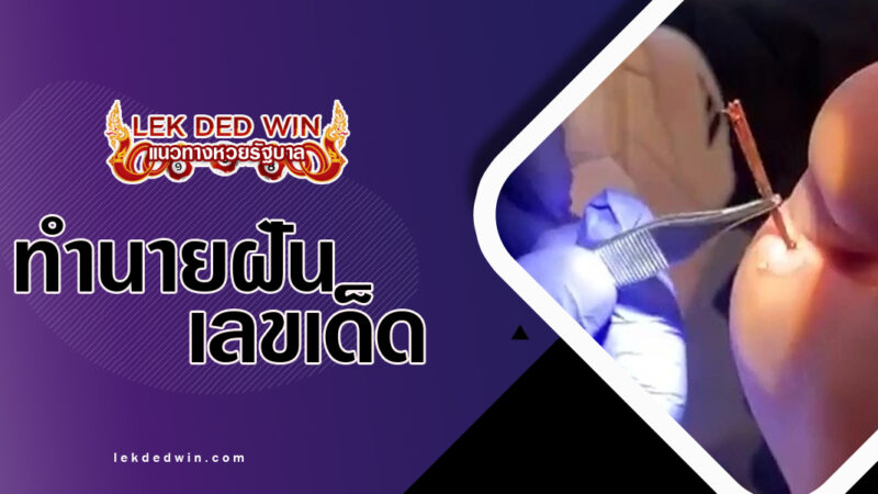 ทำนายฝันหนามตำฝ่าเท้า-พร้อมเลขเด็ด